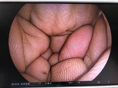 上部消化管用経鼻スコープ｜EG-530NW｜富士フイルムメディカルの写真8枚目