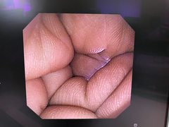 Video Gastroscope｜GIF-XP260｜Olympus Medical Systems photo8