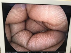 上部消化管ビデオスコープ｜EG-590WR｜富士フイルムメディカルの写真8枚目