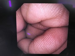 上部消化管汎用ビデオスコープ｜GIF-XP290N｜オリンパスメディカルシステムズ株式会社の写真6枚目