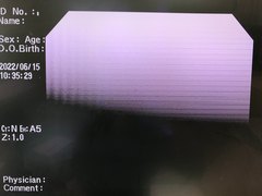 Video Colonoscope｜CF-H260AZI｜Olympus Medical Systems photo6