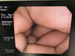 大腸ビデオスコープ｜CF-H260AZI｜オリンパスメディカルシステムズ株式会社の写真8枚目