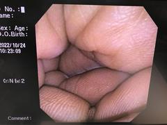 上部消化管汎用ビデオスコープ(径鼻)｜GIF-XP150N｜オリンパスメディカルシステムズ株式会社の写真8枚目