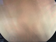 Video Gastroscope｜EG-590WR2｜Fujifilm Medical photo8