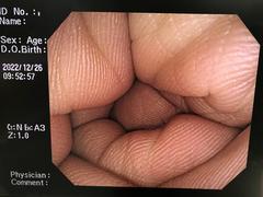 大腸ビデオスコープ｜PCF-Q260AI｜オリンパスメディカルシステムズ株式会社の写真8枚目