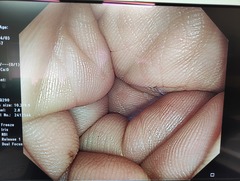 上部消化管汎用ビデオスコープ｜GIF-HQ290｜オリンパスメディカルシステムズ株式会社の写真8枚目