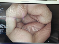 大腸ビデオスコープ｜CF-HQ290I｜オリンパスメディカルシステムズ株式会社の写真8枚目