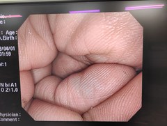 大腸ビデオスコープ｜CF-H260AI｜オリンパスメディカルシステムズ株式会社の写真8枚目