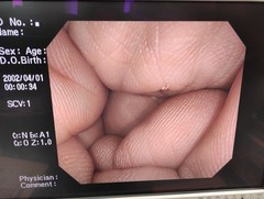 大腸ビデオスコープ｜CF-H260DI｜オリンパスメディカルシステムズ株式会社の写真6枚目