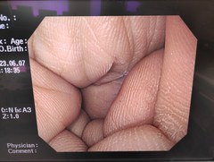 上部消化管汎用ビデオスコープ｜GIF-PQ260｜オリンパスメディカルシステムズ株式会社の写真8枚目