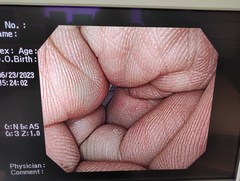 上部消化管汎用ビデオスコープ｜GIF-Q260｜オリンパスメディカルシステムズ株式会社の写真8枚目
