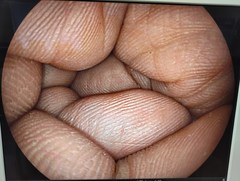 Video Transnasal Gastroscope｜EG-530NW｜Fujifilm Medical photo8