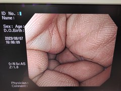上部消化管汎用ビデオスコープ｜GIF-PQ260｜オリンパスメディカルシステムズ株式会社の写真8枚目
