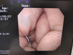 上部消化管汎用ビデオスコープ｜GIF-XQ260｜オリンパスメディカルシステムズ株式会社の写真8枚目