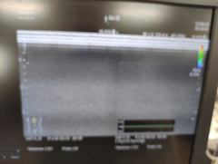 Ultrasound system｜ARIETTA 60｜Hitachi photo8