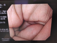 上部消化管汎用ビデオスコープ｜GIF-Q260｜オリンパスメディカルシステムズ株式会社の写真8枚目