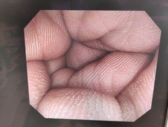 大腸ビデオスコープ｜CF-Q260AI｜オリンパスメディカルシステムズ株式会社の写真8枚目