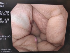 上部消化管汎用ビデオスコープ｜GIF-Q240｜オリンパスメディカルシステムズ株式会社の写真8枚目