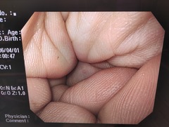 Video Gastroscope｜GIF-H260｜Olympus Medical Systems photo8
