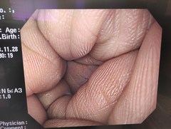 上部消化管汎用ビデオスコープ｜GIF-Q260｜オリンパスメディカルシステムズ株式会社の写真8枚目
