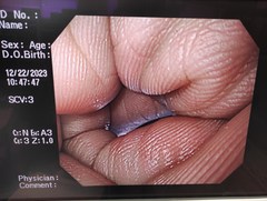 上部消化管汎用ビデオスコープ｜GIF-Q240｜オリンパスメディカルシステムズ株式会社の写真8枚目