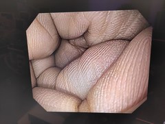 上部消化管汎用ビデオスコープ｜GIF-Q150X｜オリンパスメディカルシステムズ株式会社の写真7枚目