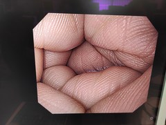 上部消化管汎用ビデオスコープ｜GIF-H290｜オリンパスメディカルシステムズ株式会社の写真8枚目