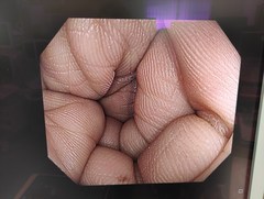 大腸ビデオスコープ｜CF-H290I｜オリンパスメディカルシステムズ株式会社の写真7枚目