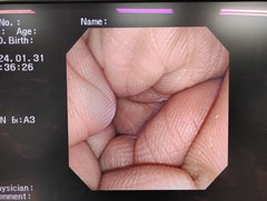 Video Transnasal Gastroscope｜GIF-XP260N｜Olympus Medical Systems photo8