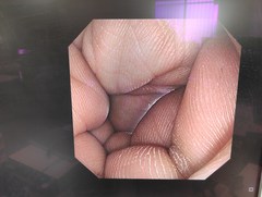 上部消化管汎用ビデオスコープ｜GIF-XP290N｜オリンパスメディカルシステムズ株式会社の写真8枚目