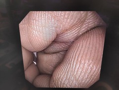 上部消化管経鼻スコープ｜GIF-XP170N｜オリンパスメディカルシステムズ株式会社の写真8枚目