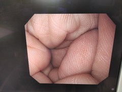 上部消化管汎用ビデオスコープ｜GIF-H290｜オリンパスメディカルシステムズ株式会社の写真8枚目