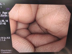 上部消化管汎用ビデオスコープ｜GIF-Q260｜オリンパスメディカルシステムズ株式会社の写真8枚目