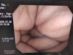 大腸ビデオスコープ｜CF-Q260AI｜オリンパスメディカルシステムズ株式会社の写真8枚目