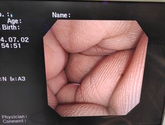 Video Transnasal Gastroscope｜GIF-N260｜Olympus Medical Systems photo8