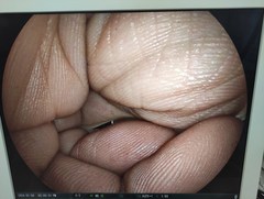上部消化管用経鼻スコープ｜EG-580NW｜富士フイルムメディカルの写真8枚目