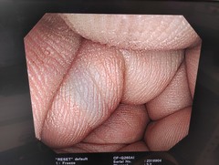 大腸ビデオスコープ｜CF-Q260AI｜オリンパスメディカルシステムズ株式会社の写真8枚目