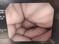 大腸ビデオスコープ｜CF-Q240L｜オリンパスメディカルシステムズ株式会社の写真8枚目