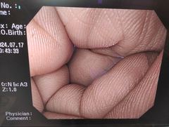 上部消化管汎用ビデオスコープ｜GIF-Q260｜オリンパスメディカルシステムズ株式会社の写真8枚目