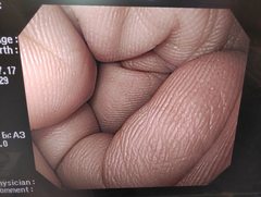 上部消化管汎用ビデオスコープ｜GIF-H260｜オリンパスメディカルシステムズ株式会社の写真8枚目