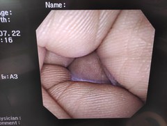 上部消化管汎用ビデオスコープ｜GIF-XP260NS｜オリンパスメディカルシステムズ株式会社の写真8枚目