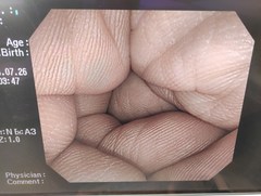 大腸ビデオスコープ｜CF-H260AI｜オリンパスメディカルシステムズ株式会社の写真8枚目