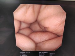 上部消化管汎用ビデオスコープ｜GIF-XP260NS｜オリンパスメディカルシステムズ株式会社の写真8枚目