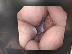 上部消化管汎用ビデオスコープ｜GIF-XQ260｜オリンパスメディカルシステムズ株式会社の写真8枚目
