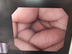 上部消化管汎用ビデオスコープ｜GIF-Q260｜オリンパスメディカルシステムズ株式会社の写真8枚目