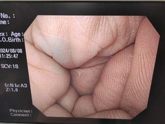 上部消化管汎用ビデオスコープ｜GIF-Q260｜オリンパスメディカルシステムズ株式会社の写真8枚目