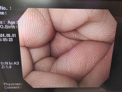 上部消化管汎用ビデオスコープ｜GIF-H260｜オリンパスメディカルシステムズ株式会社の写真8枚目