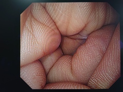 上部消化管汎用ビデオスコープ｜GIF-H290｜オリンパスメディカルシステムズ株式会社の写真8枚目