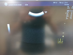超音波診断装置｜LOGIQ P9｜GEヘルスケアの写真8枚目