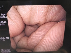 上部消化管汎用ビデオスコープ｜GIF-H260｜オリンパスメディカルシステムズ株式会社の写真7枚目